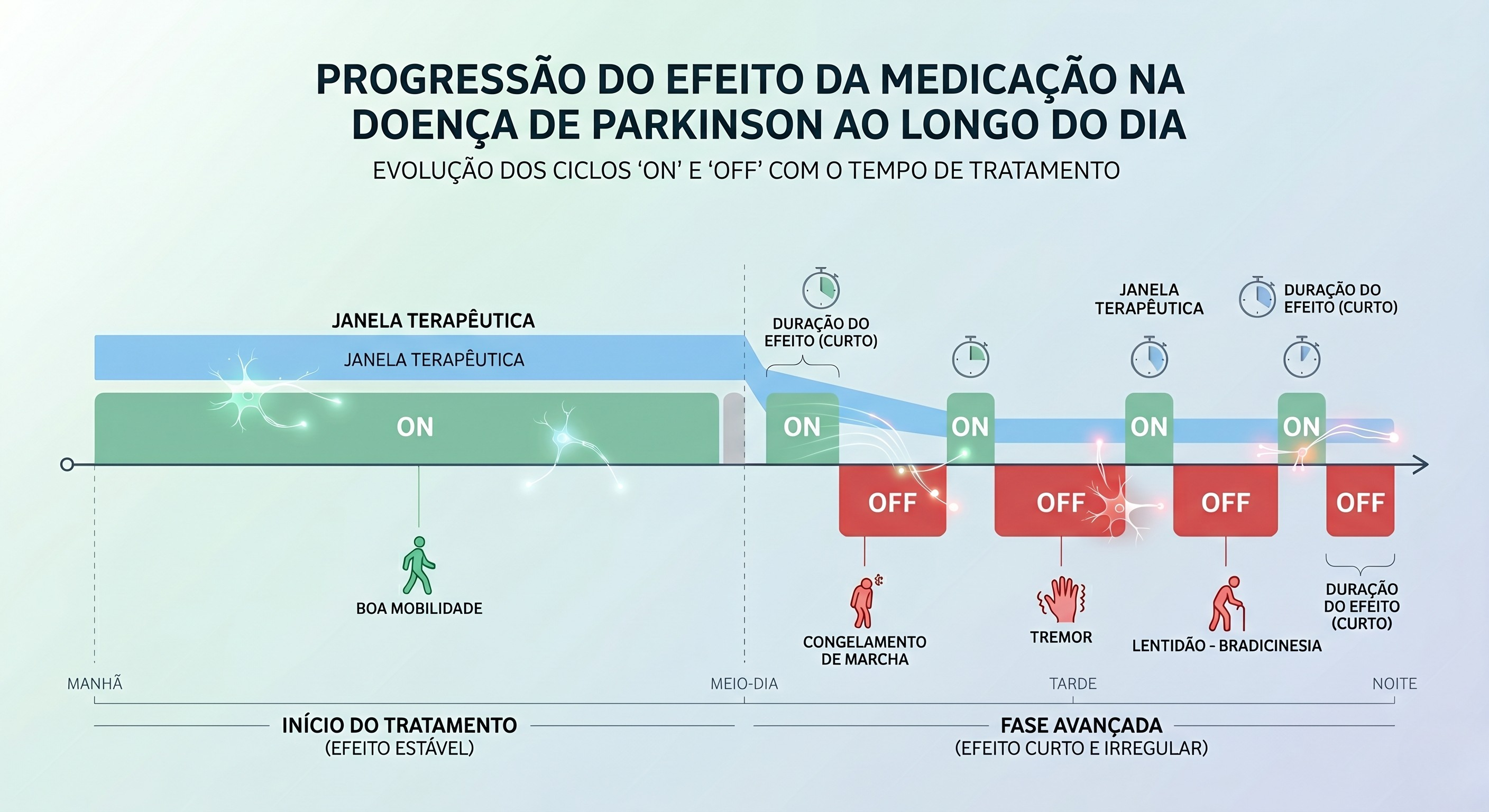 Quando o remédio deixa de durar - Representação de flutuações motoras